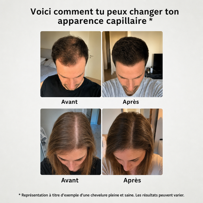 Huile capillaire bio premium Croissance+